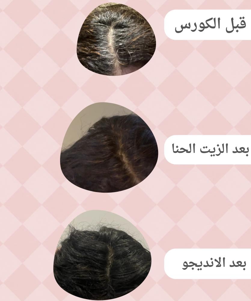 بكج الشيب الطبيعي 100%