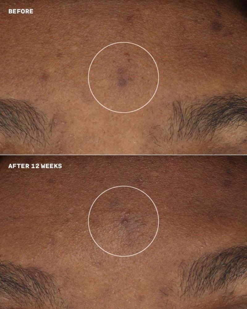 مرطب ومصحح لون البشرة إيفين بيتر بعامل حماية SPF 20 من إستي لودر - 50ml