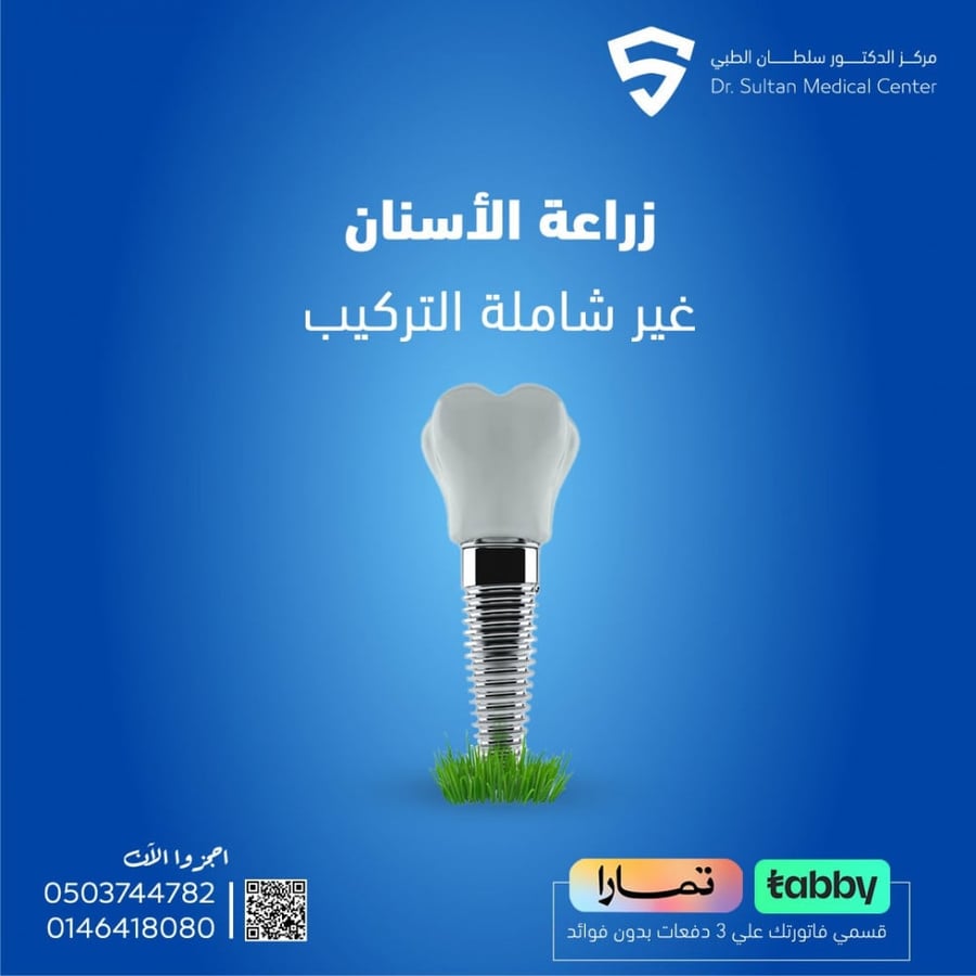 زراعة الأسنان شامله التركيب