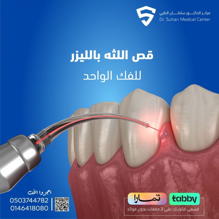 قص اللثه بالليزر