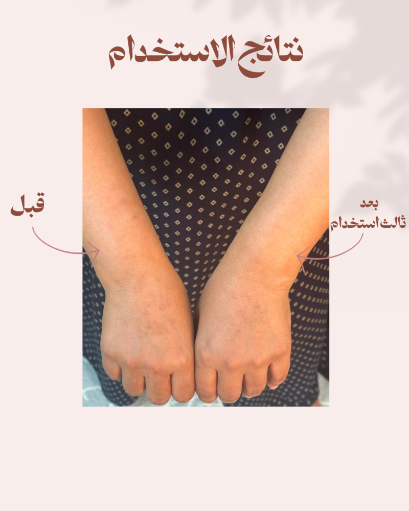 دلكة المرايه