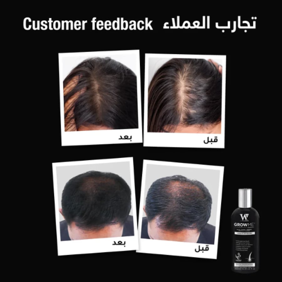 شامبو جرومي لزياده نمو  الشعر وتقويته 250 مل