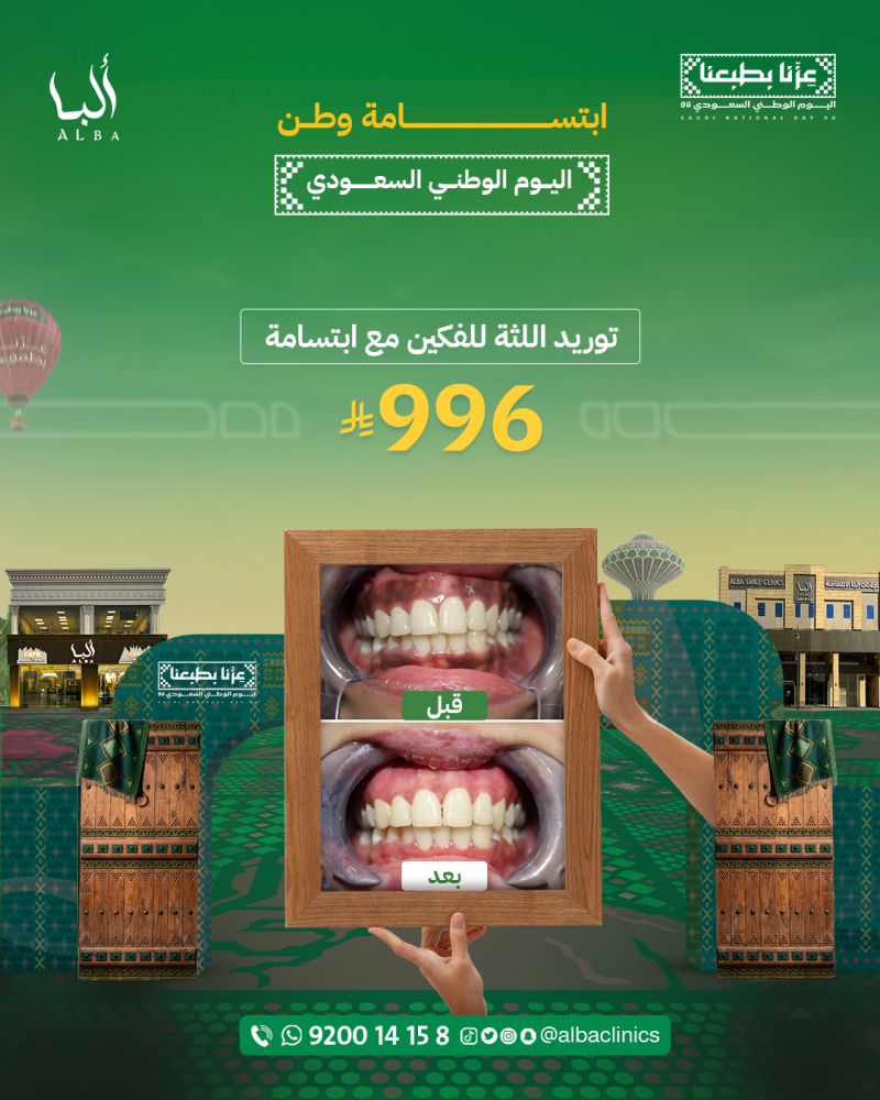 توريد اللثة للفكين مع ابتسامة