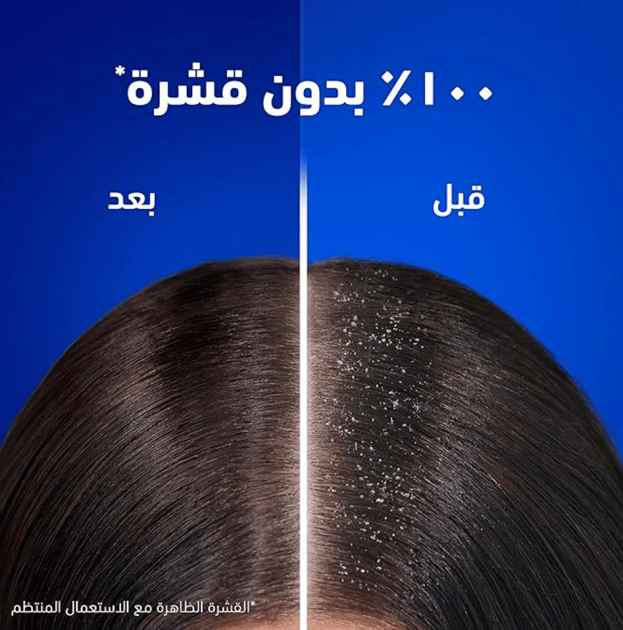 شامبو هيد اند شولدرز انسيابي وحريري 190 مل