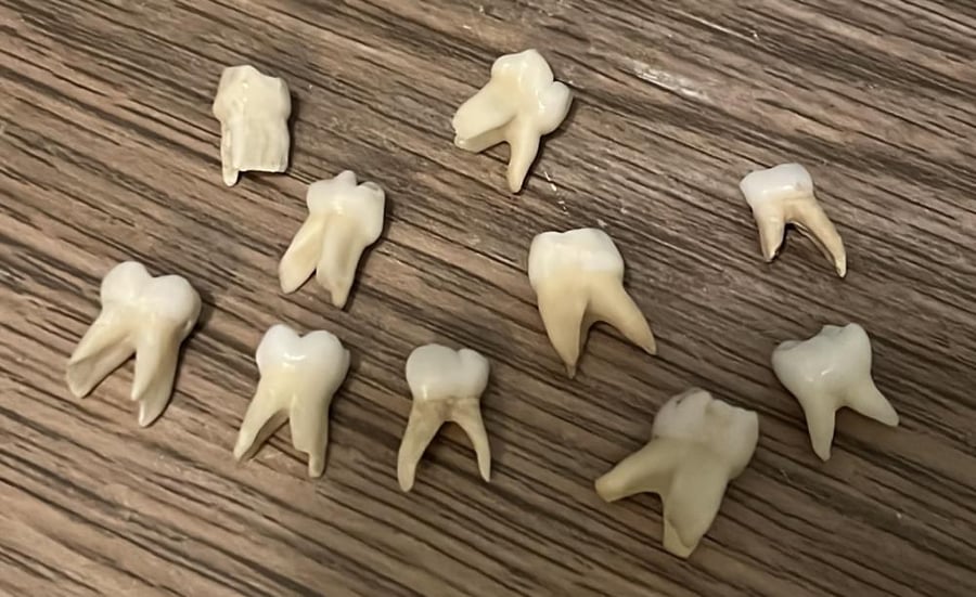 NATURAL primary molar