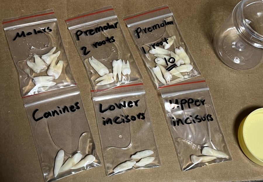 NATURAL mandibular premolar (1-root)