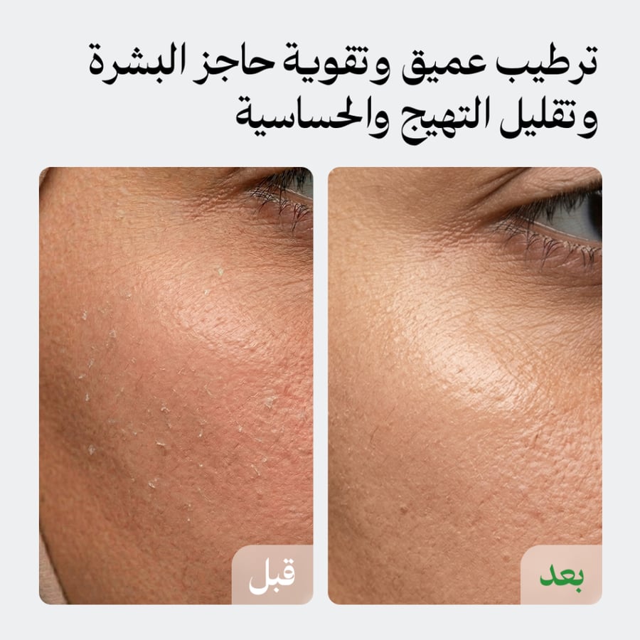 مجموعة الهالات والترطيب