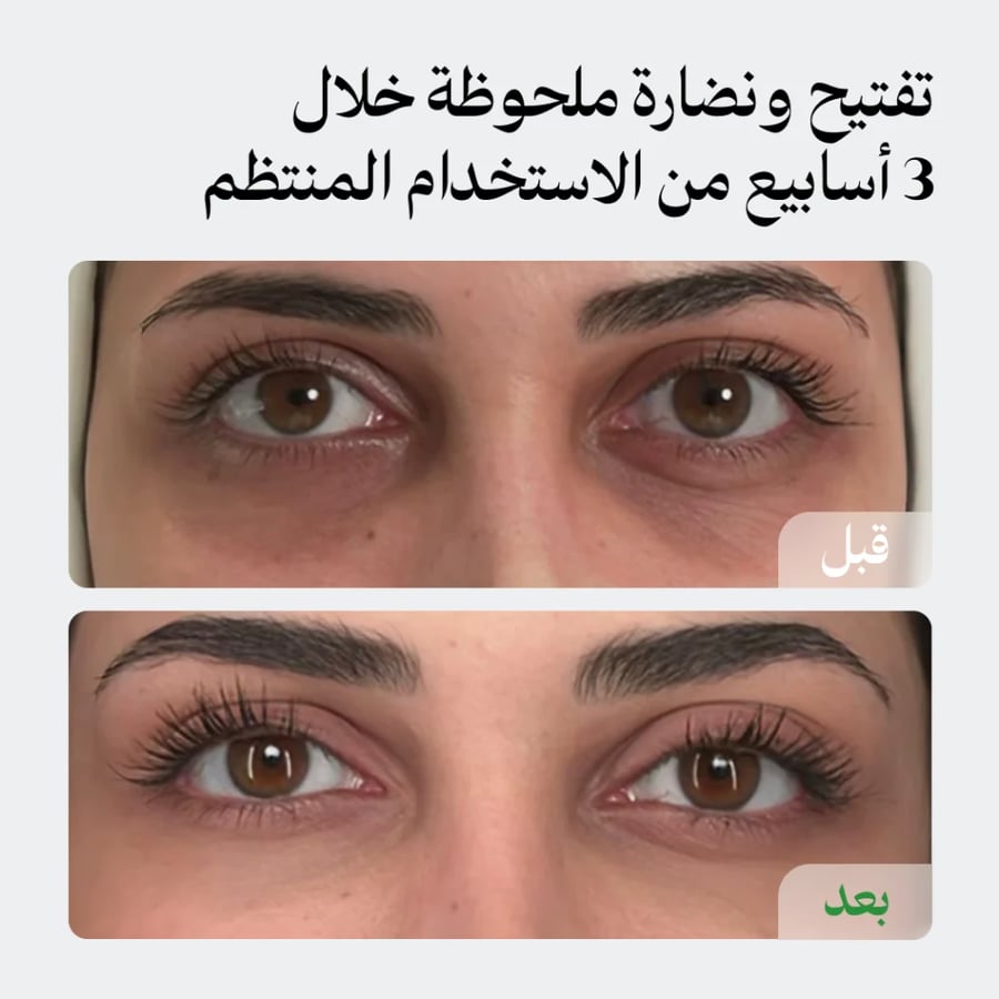 كريم الهالات للتفتيح والنضارة