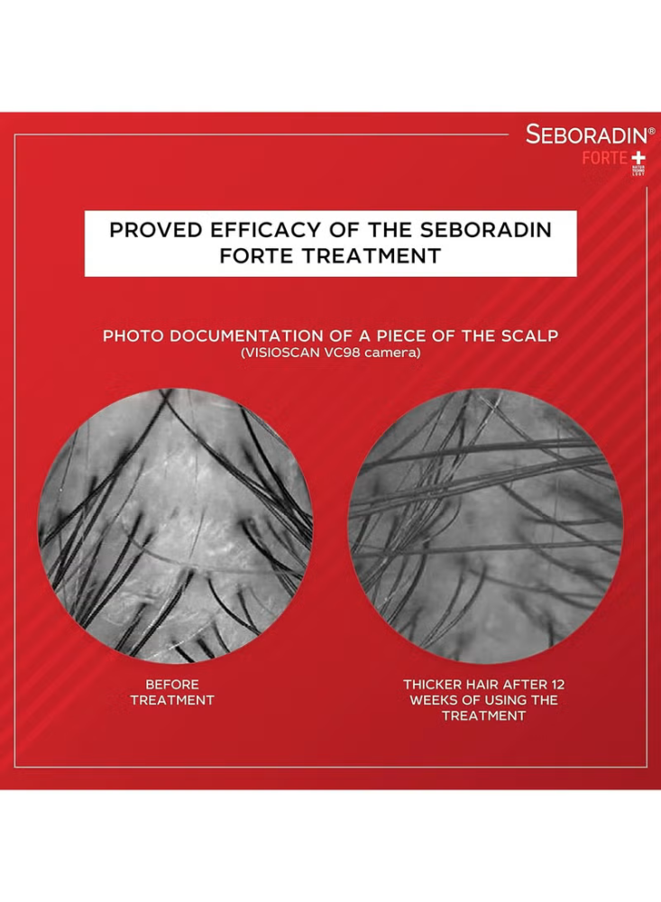 أمبولات سيبورادين فورت لعلاج تساقط الشعر المزمن - Seboradin Forte Anti-Hair Loss Ampoules