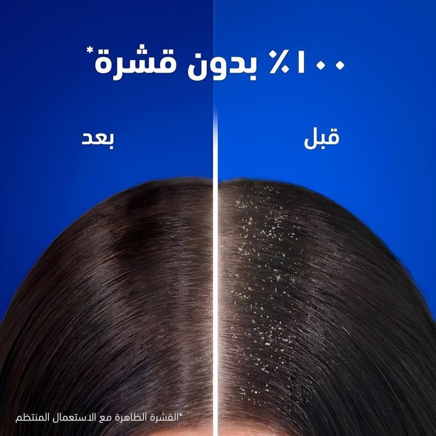 شامبو هيد آند شولدرز (Head & Shoulders) - انتعاش الجليد (Ice Fresh) - لراحة فورية من الحكة المرافقة للقشرة - 350 مل
