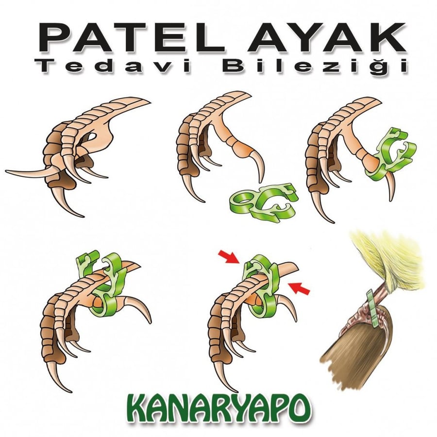 كلبشات لإلتواء اصبع الكناري