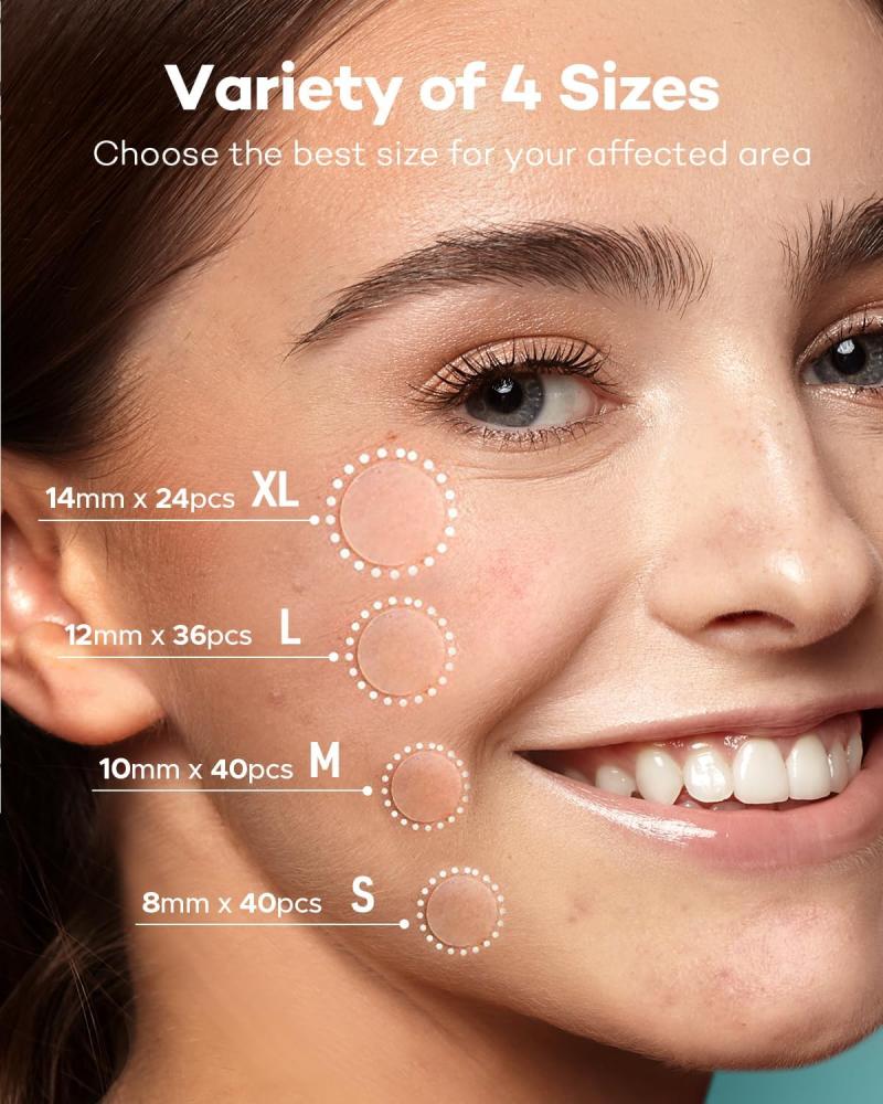 TKTK Pimple Patch for Face, Hydrocolloid Acne Absorbing Dots, 4 Sizes 140CT
