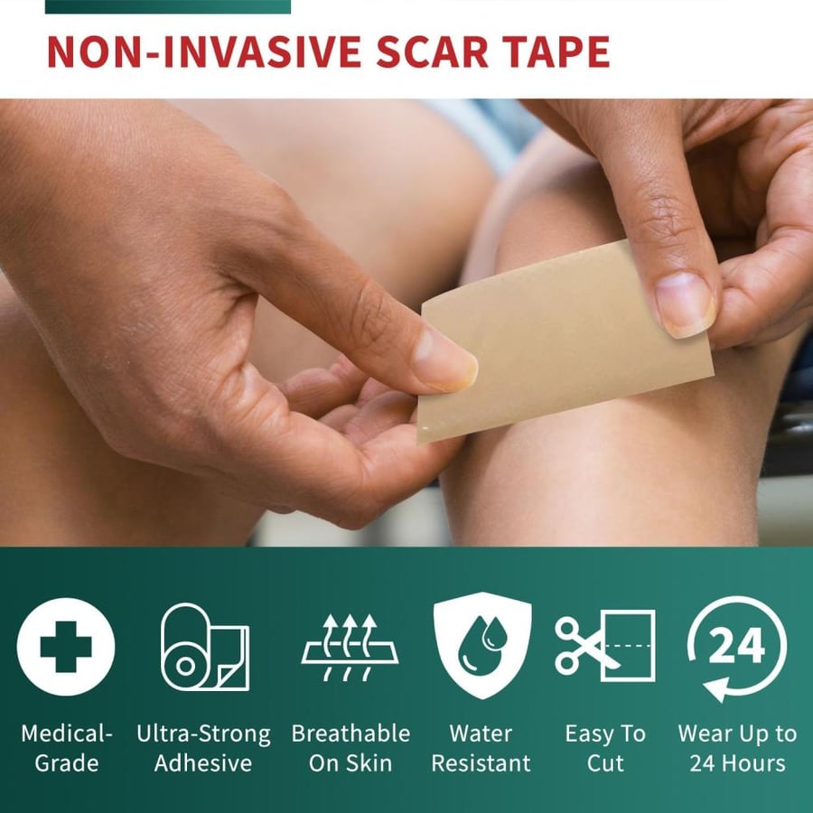 Silicone Scar Sheets 1.6" x 118" Roll-3M - Medical Scar Tape