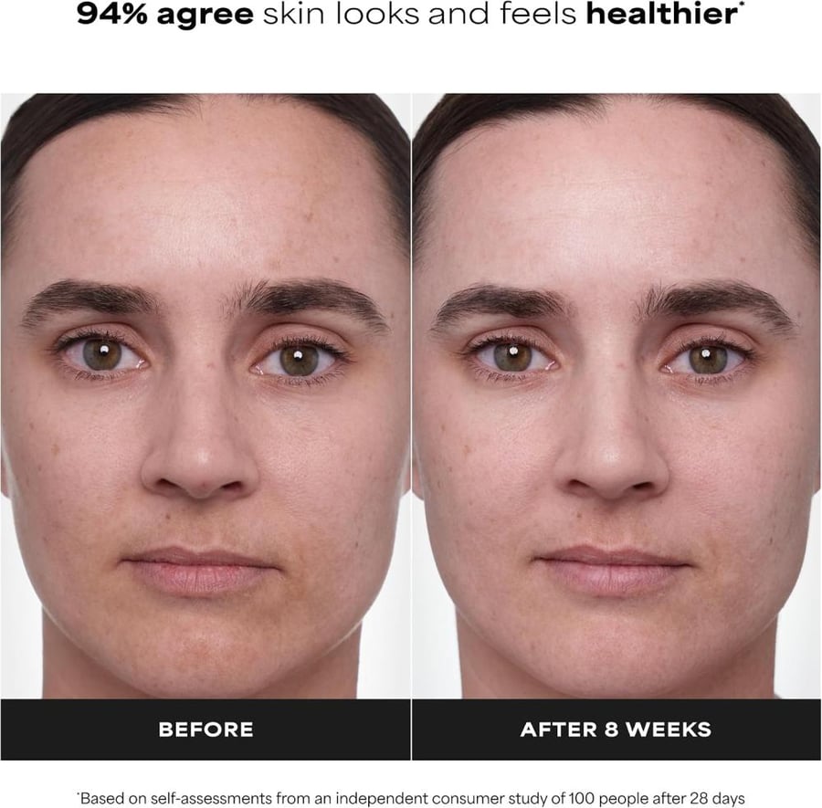 PAULA'S CHOICE CLINICAL 1% Retinol Treatment Cream | Peptides, Vitamin C & Licorice Extract |.