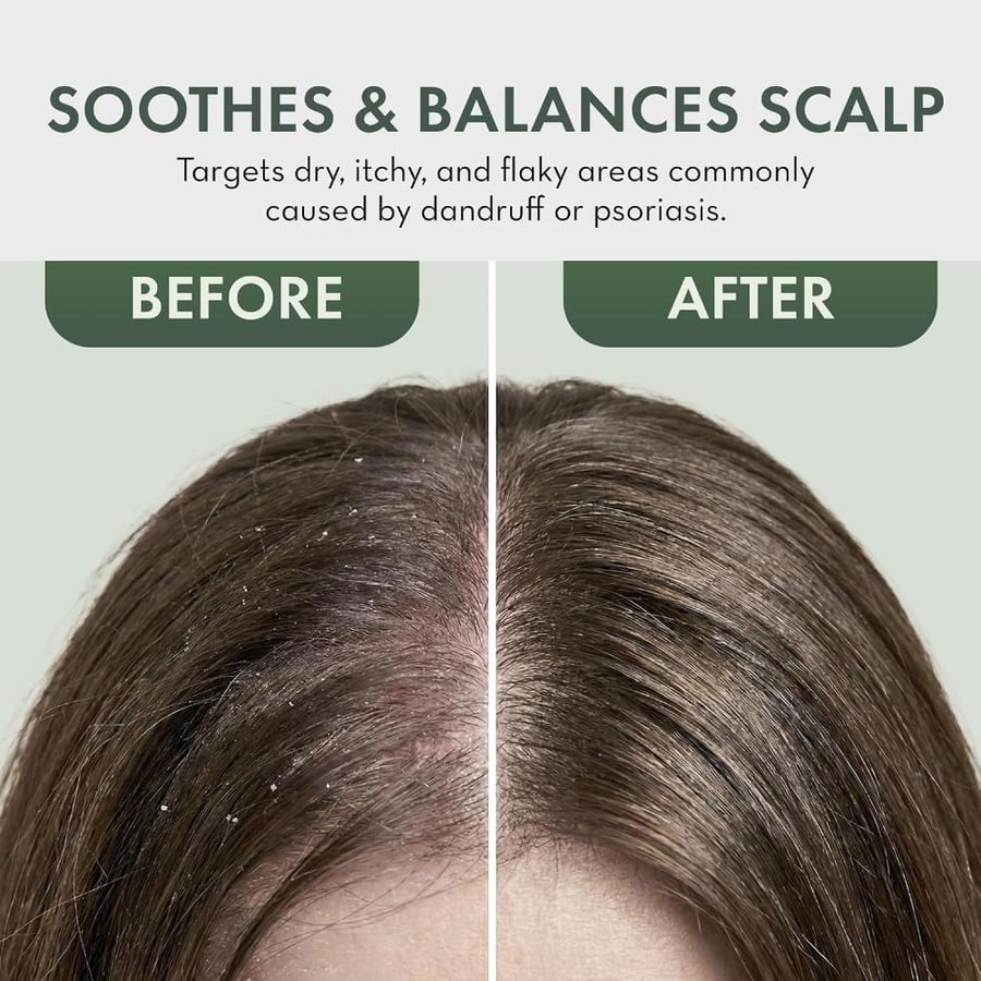 Pharm to Table Scalp Relief Tea Tree Leave-in