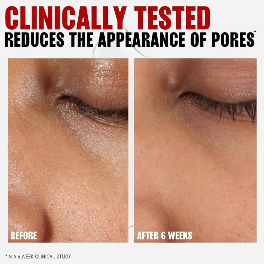 THAYERS Alcohol-Free Witch Hazel Facial Toner with Aloe Vera Formula, Rose Petal, 12 Fl Oz
