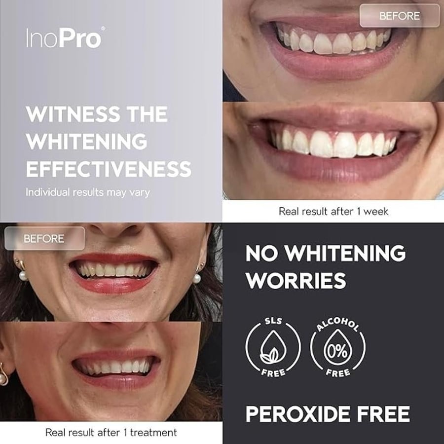شرائط تبييض الأسنان الطبيعية InoPro Advance للأسنان الحساسة 14 جلسة (28 شريطاً)