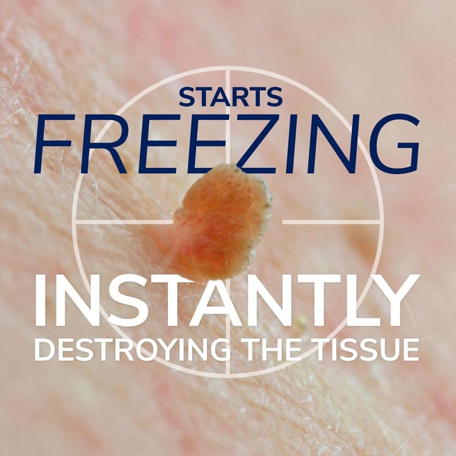 Dr. Scholl's Freeze Away SKIN TAG REMOVER, 8 Ct // Removes Skin Tags in As Little As 1 Treatment, FDA-Cleared, Clinically Proven, 8 Treatments