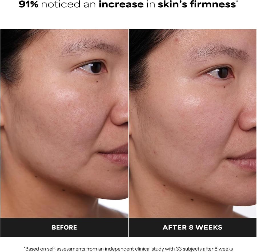 PAULA'S CHOICE CLINICAL 1% Retinol Treatment Cream | Peptides, Vitamin C & Licorice Extract |.