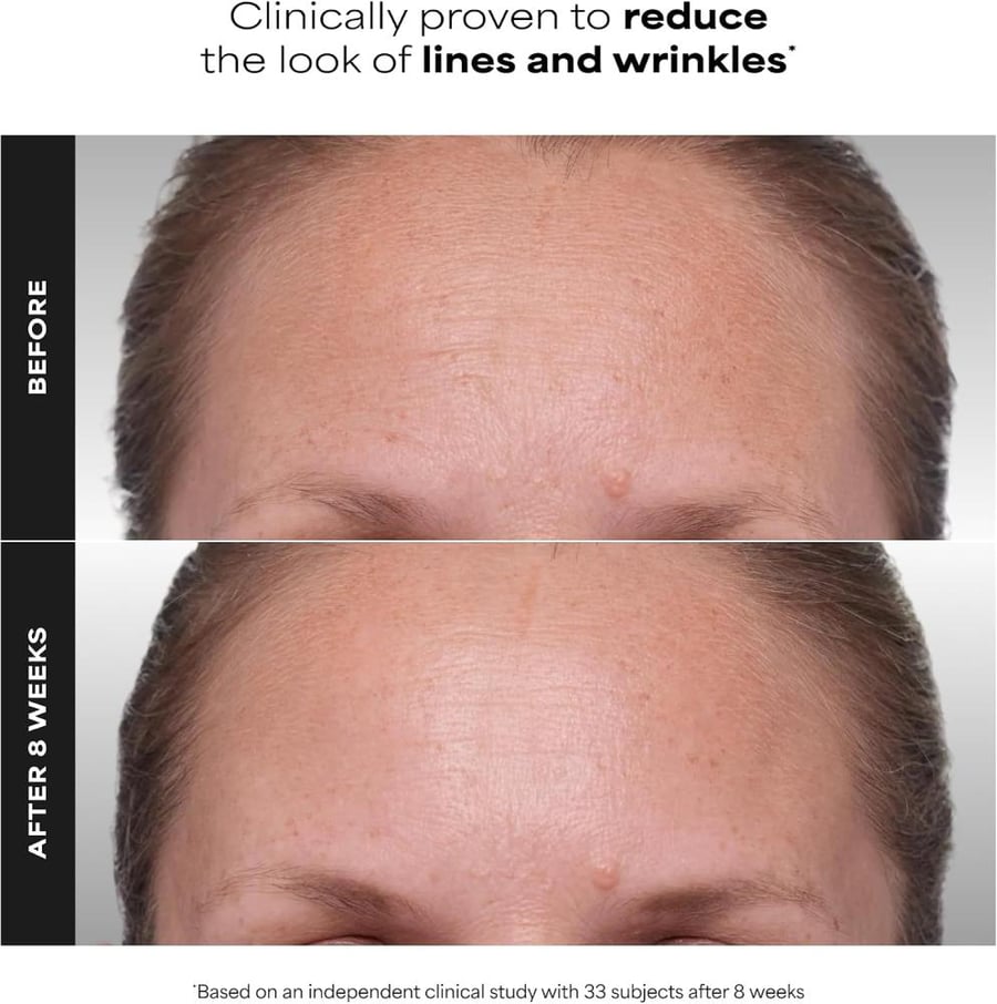 PAULA'S CHOICE CLINICAL 1% Retinol Treatment Cream | Peptides, Vitamin C & Licorice Extract |.