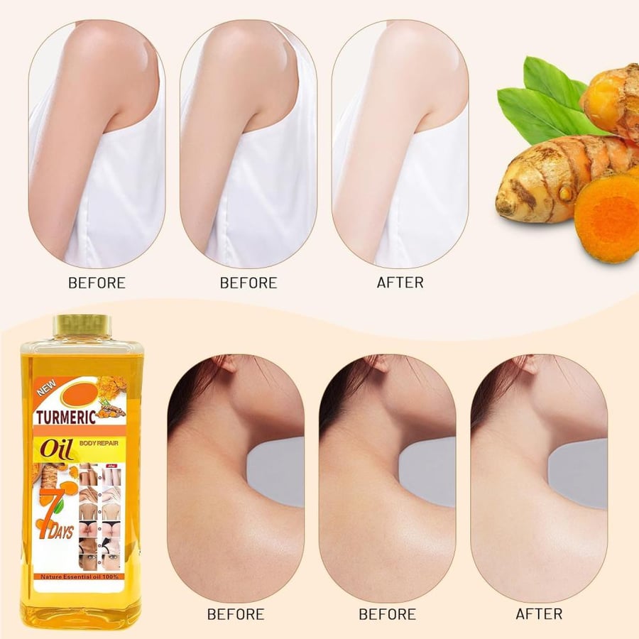 Lucift Soft 7 oil, Soft 7 Turmeric Oil, Soft 7 Turmeric oil for skin, Natural Moisturizing Nourishing for Face and Body Oil For All Skin Types