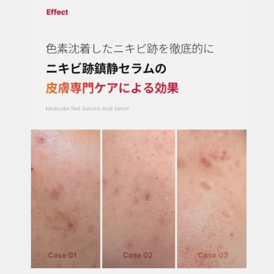 Medicube Red Succinic Acid Clarifying Serum 30ml