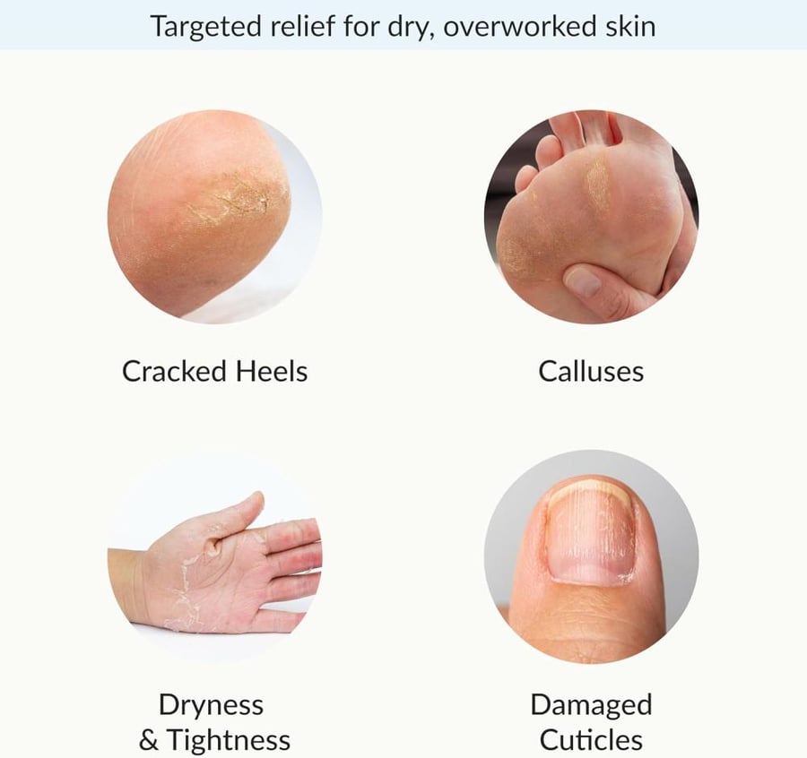 Epielle Intensive Repairing Masks for Hand and Foot - 6 Glove & 6 Socks Dry Hand, Dry & Cracked Heel to Toe Spa Masks Coconut Oil + Milk Extract,Mothers Day Gifts