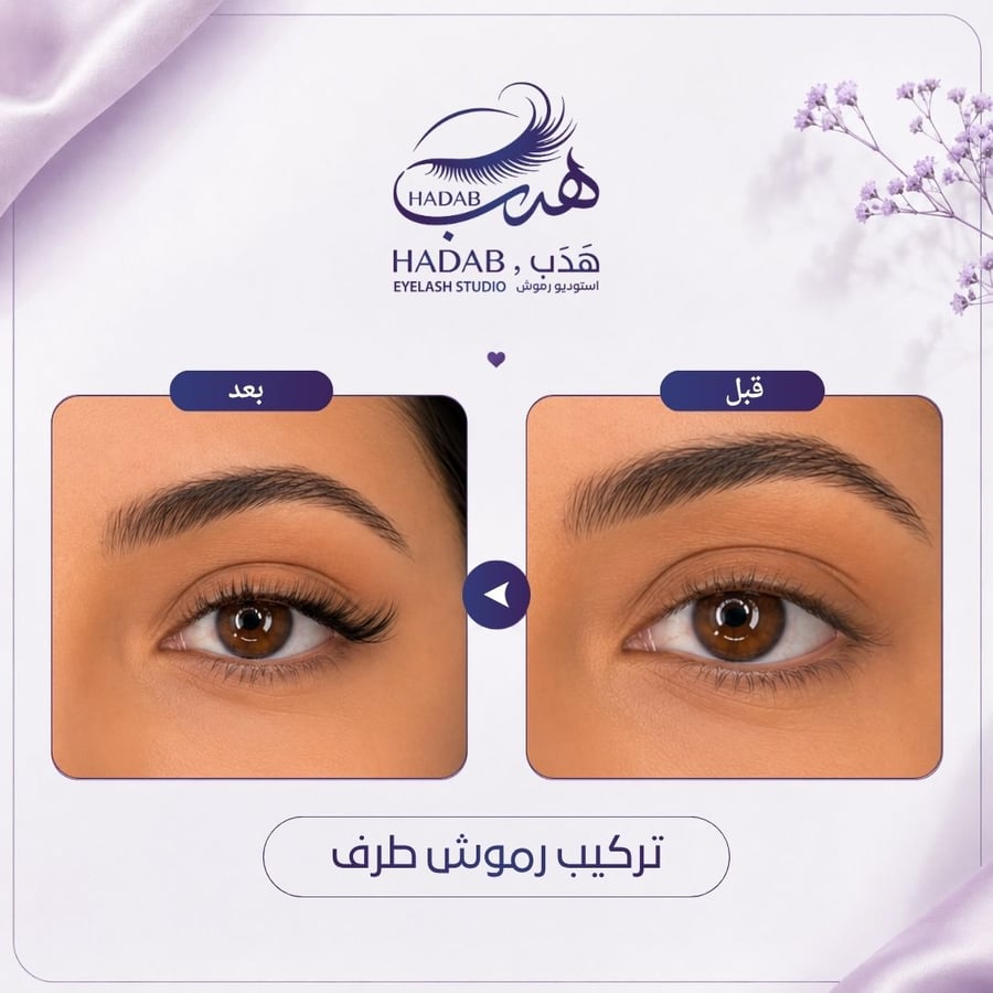 طرف Out corner