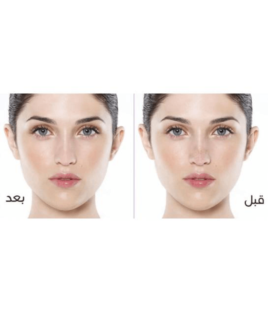 لصقات الانف من كيلان