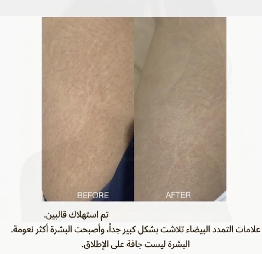 Sathida Choco Bar Soap