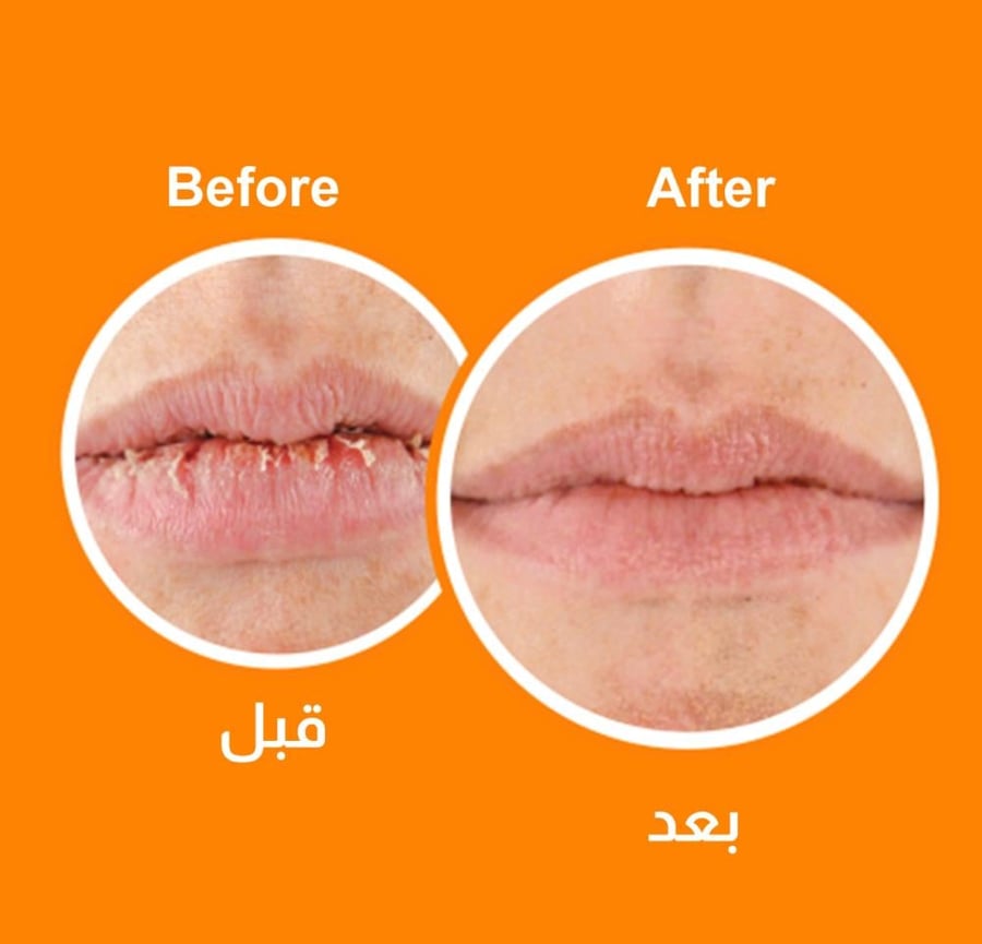 مرطب للشفاه مع واقي شمس SPF15 من اوكفيز - 4.20جرام