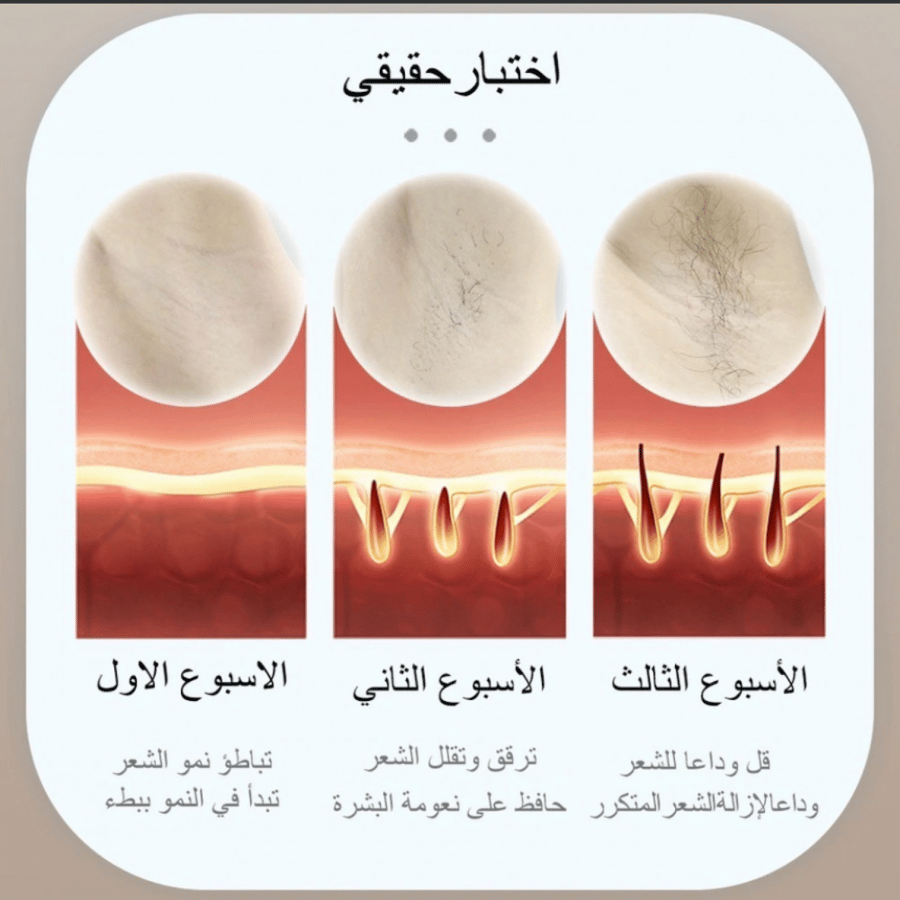 ليزر ملاي T14 بخاصية التبريد (احدث جهاز ملاي)