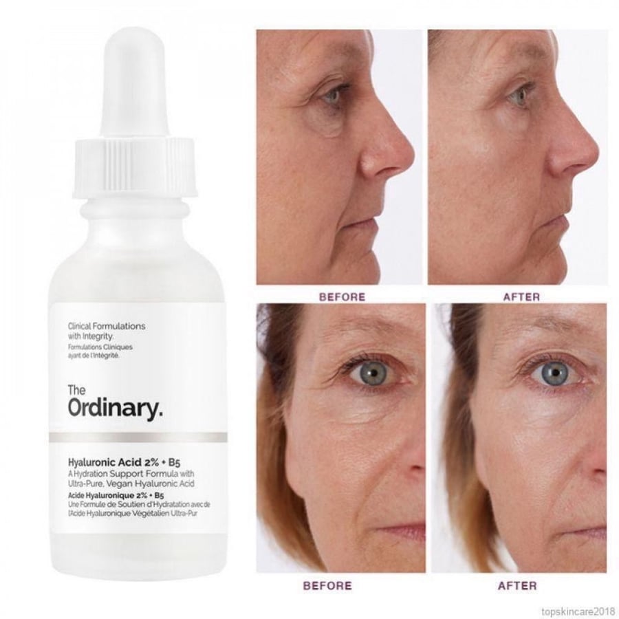 سيروم الهالورونيك + بي فايف من ذا اورديناري - THE ORDINARY HYALURONIC ACID 2% + B5