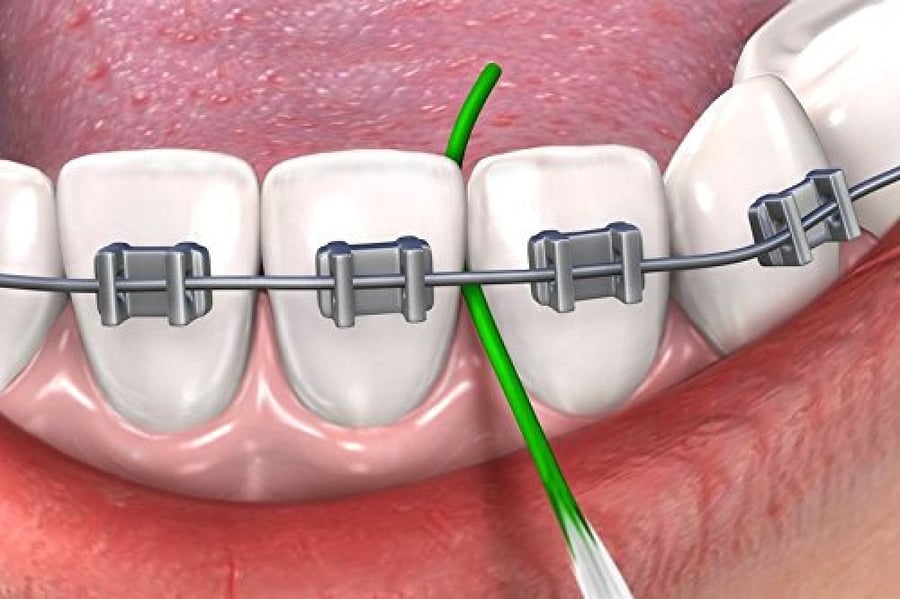 gum floss