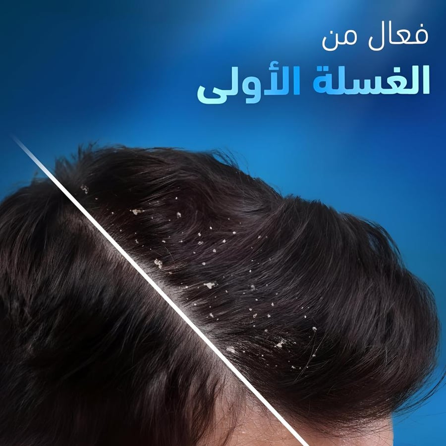 Hair Shampoo With Sea Minerals For Sever Flaky Scalp Anti Dandruff By Head & shoulder - 400ml