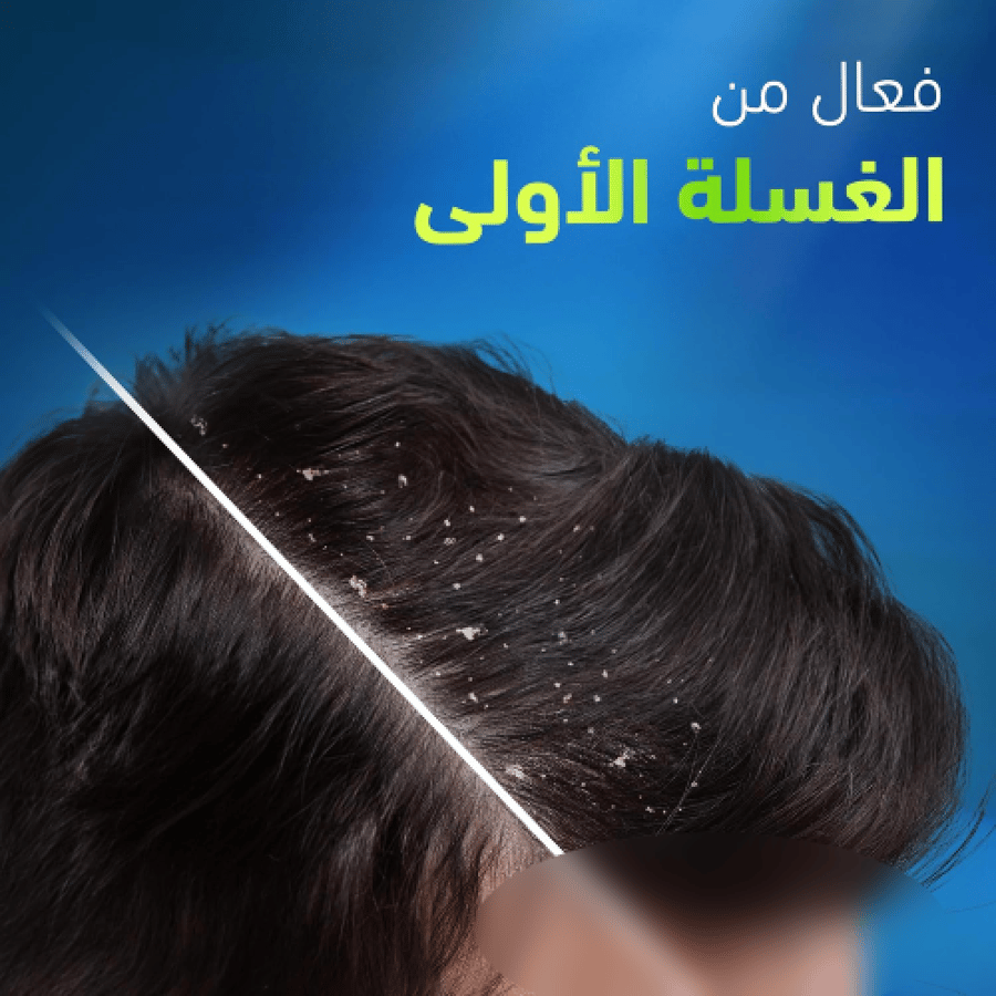 شامبو هيد اند شولدرز لفروة الرأس الدهنية الشديدة بالليمون - 400 مل