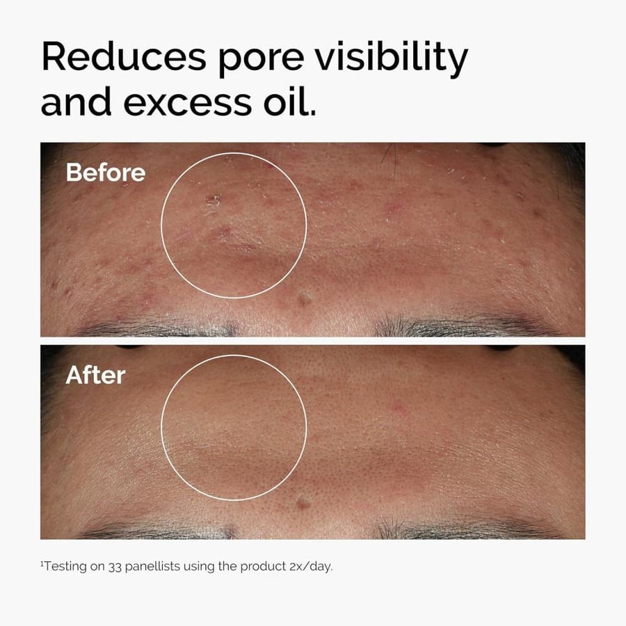 Hyaluronic Acid 2% + B5 skin moisturizing from The Ordinary 30 ml