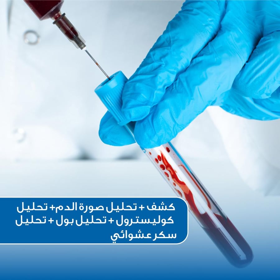 تحليل صورة الدم + تحليل كوليسترول + تحليل بول +تحليل سكر عشوائي + كشف