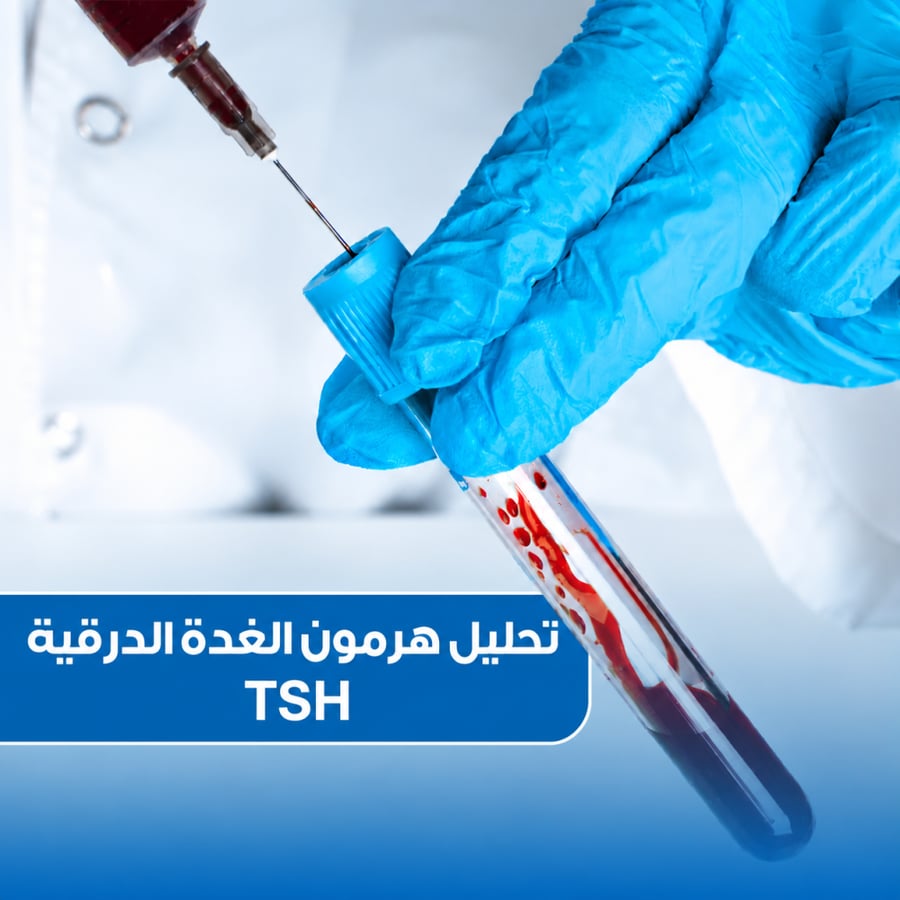 تحليل هرمون الغدة الدرقية