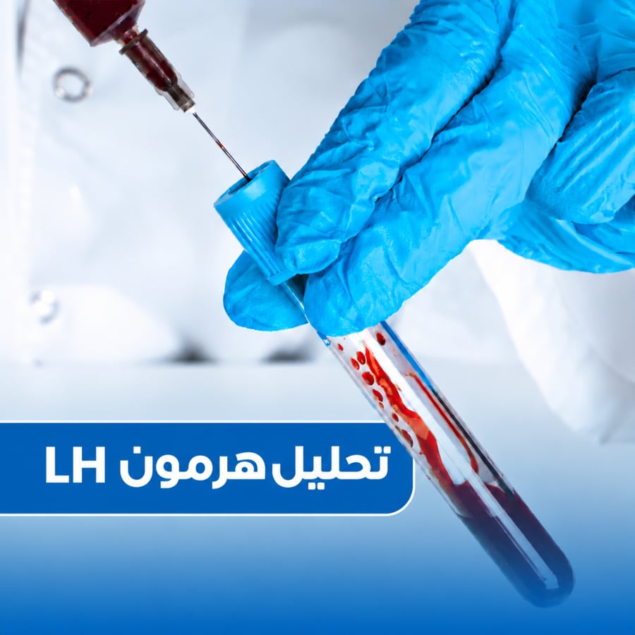 تحليل هرمون LH