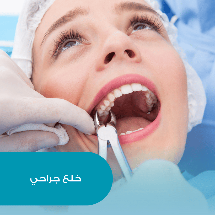 خلع جراحي