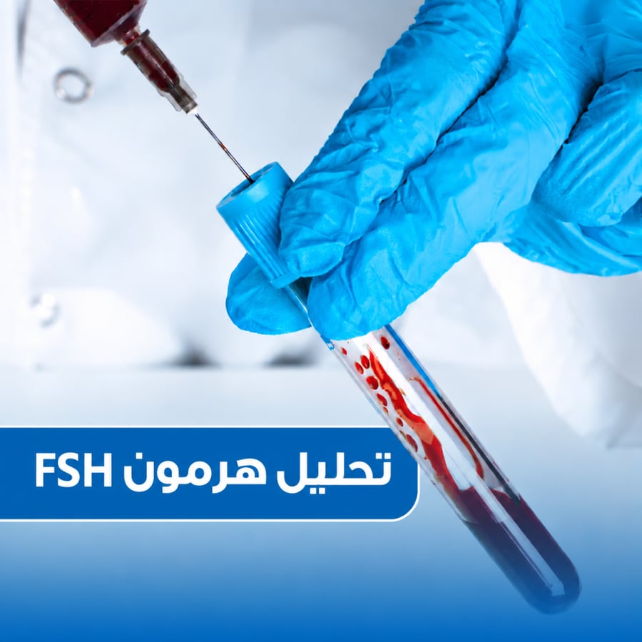 تحليل هرمون FSH