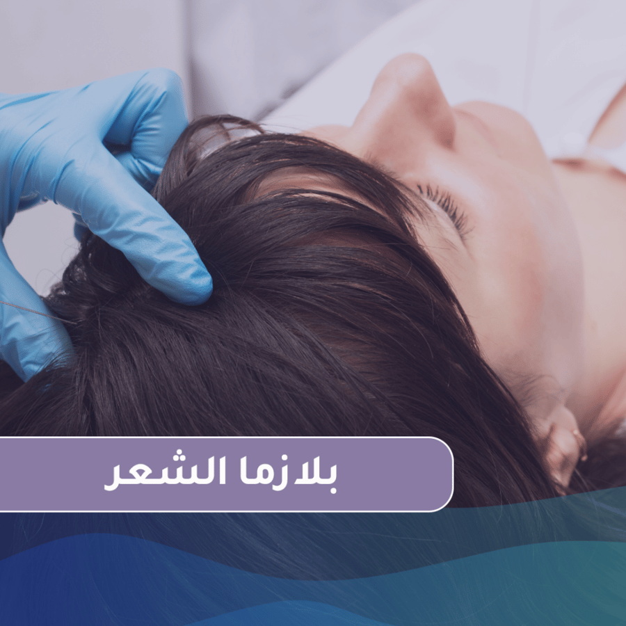 جلسة بلازما للشعر