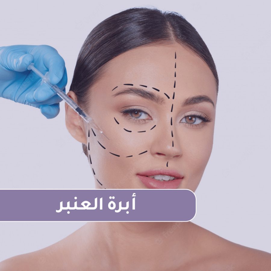 أبرة العنبر + تنظيف عميق