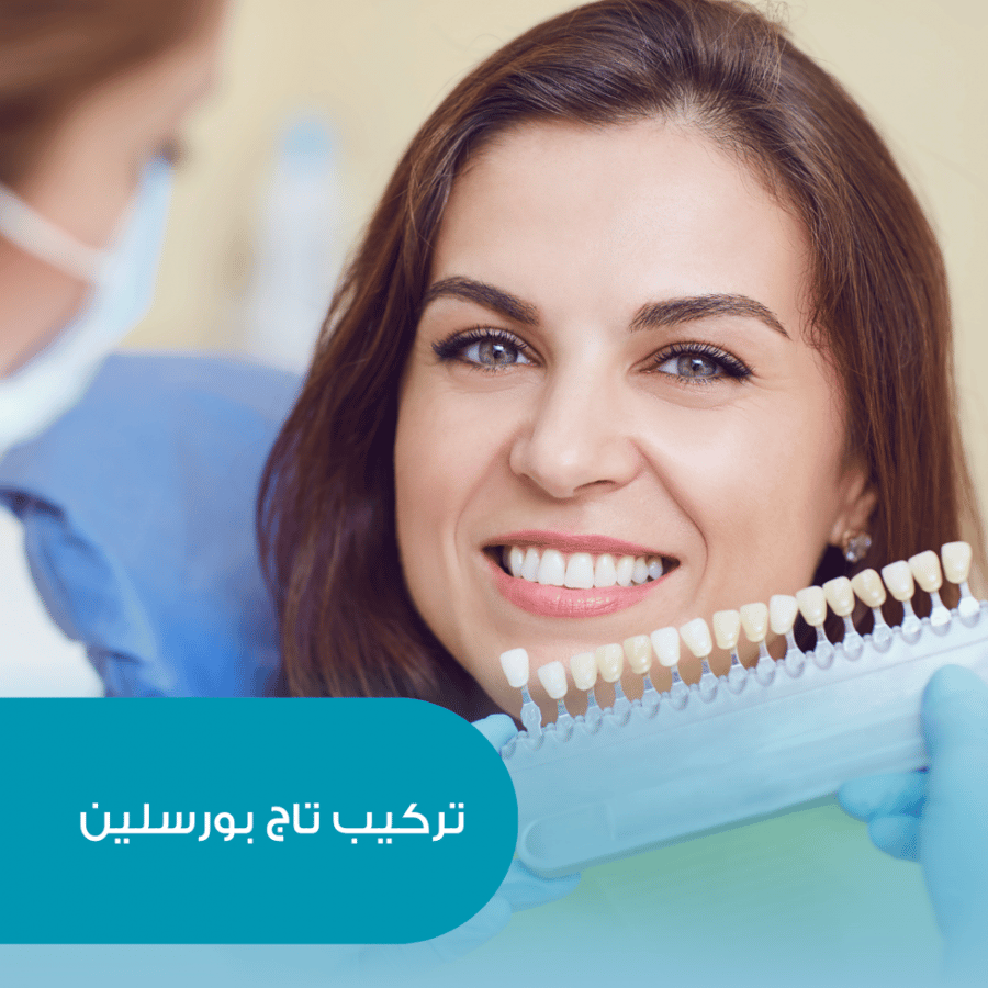 تركيب تاج بورسلين -للسن الواحد