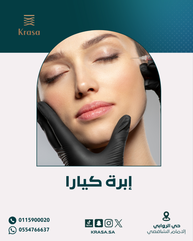 ابرة كيارا - Kiara