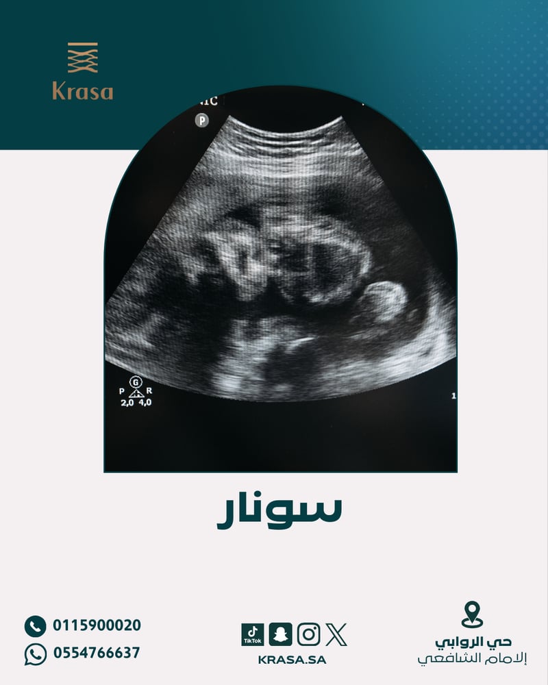 كشفيه مع سونار عادي