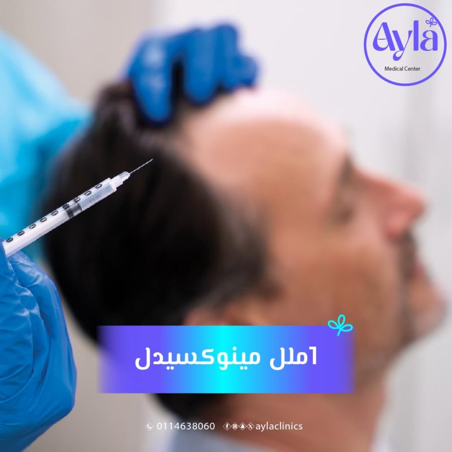 Minoxidil 1 ml
