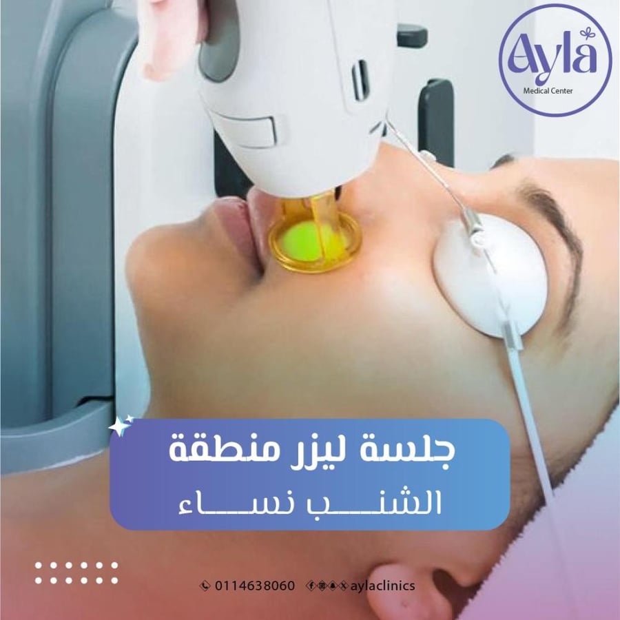 Laser session for the mustache area women