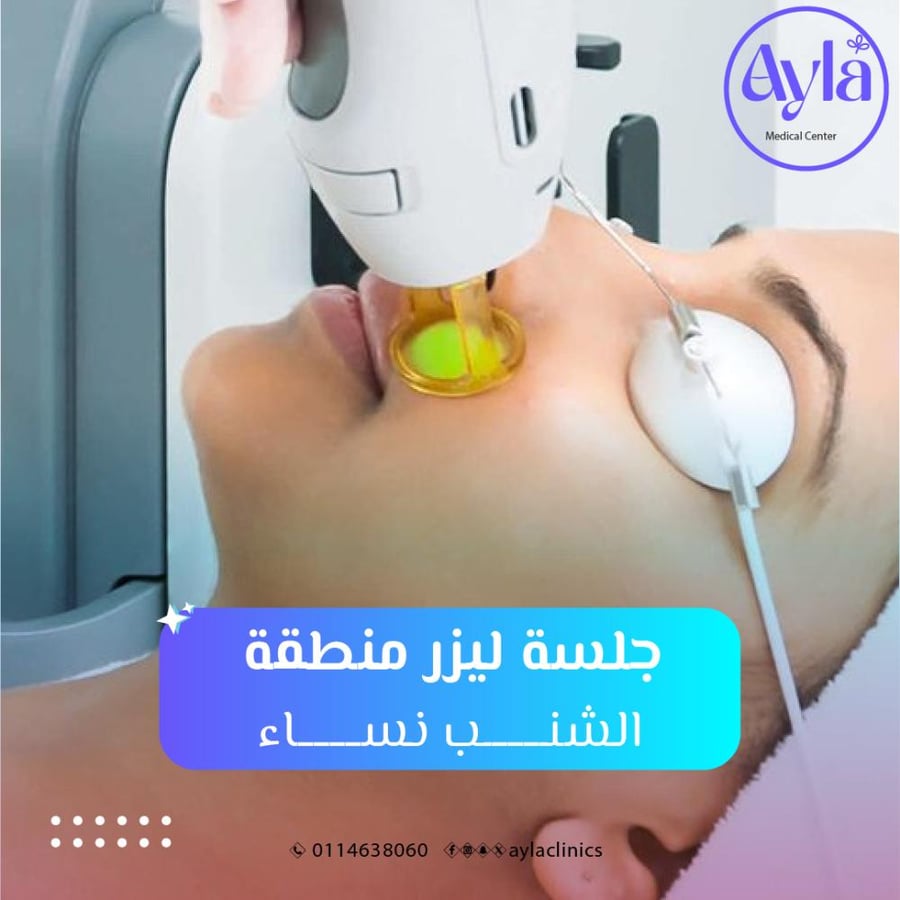 Laser session for the mustache area women